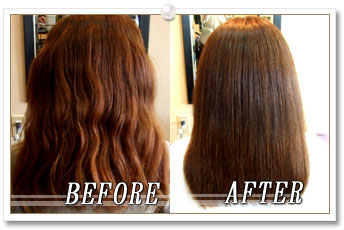 ビフォーアフター写真