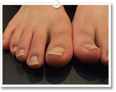 ネイルイメージ